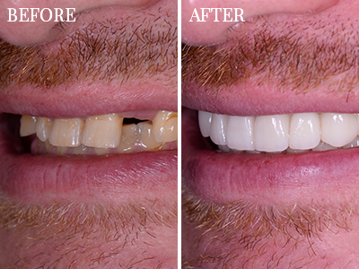 Dentistry BEFORE-AFTER
