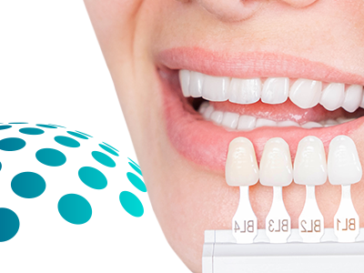 Dental Veneers