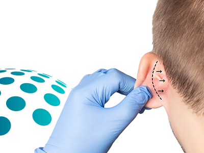 Otoplasty 