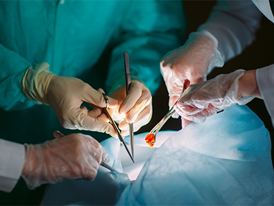 Organ Transplantation